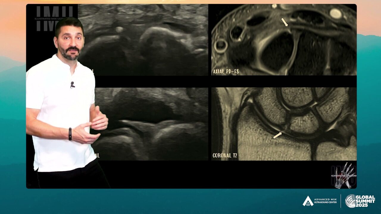 Dr. Gonzalo Serrano-Belmar presenting beside ultrasound and MRI images of the hand and wrist