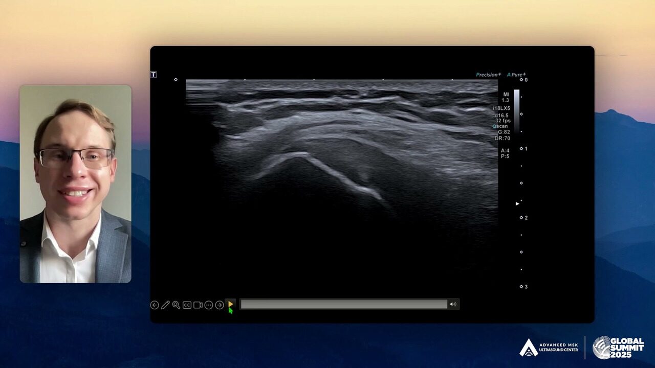 Dr. Matiss Mezals on camera beside a shoulder ultrasound image