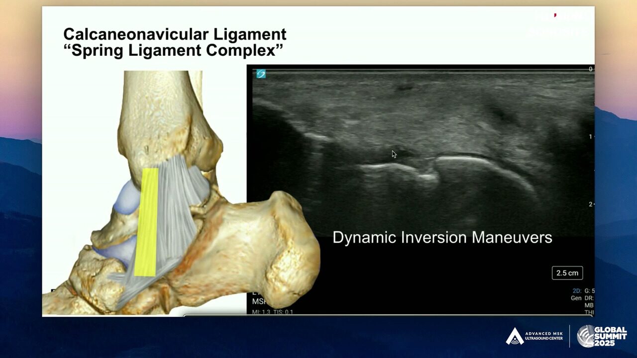 Daniel Shelton's 2025 session: an ankle anatomy model beside a live ultrasound image of the spring ligament